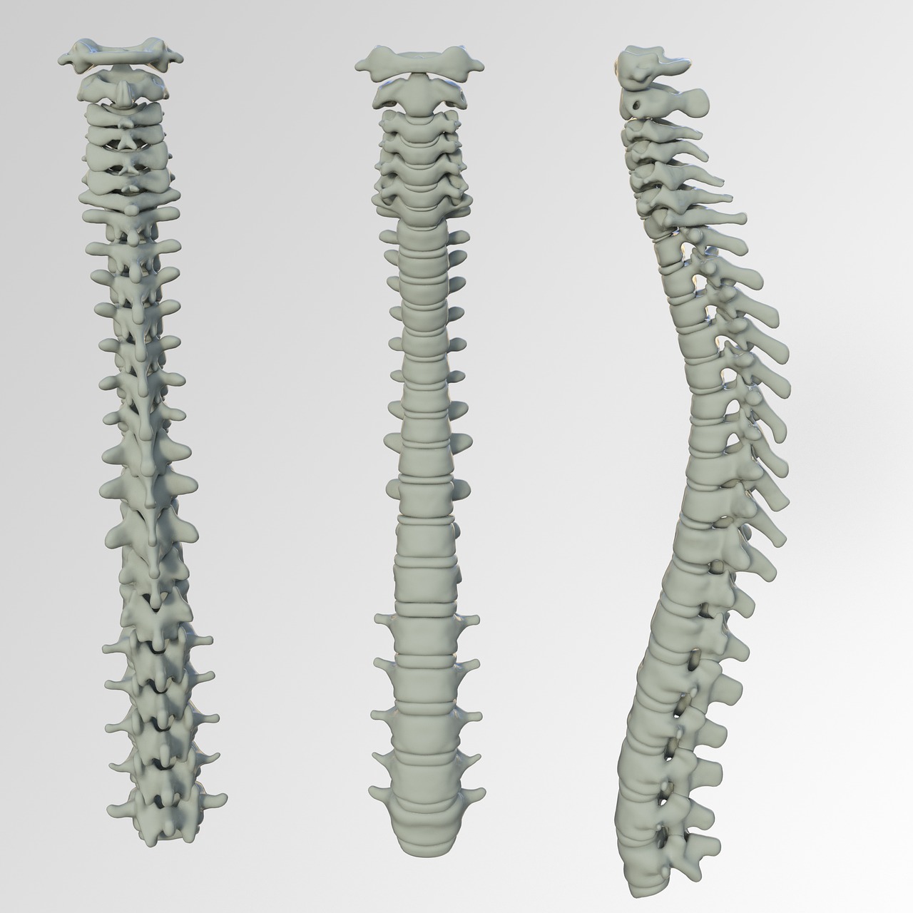 Spinal Screenings Chandler, AZ